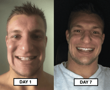Load image into Gallery viewer, Snow® At-Home Teeth Whitening Kit
